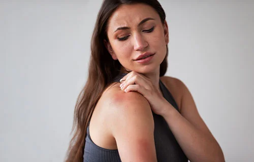 Skin Allergy
